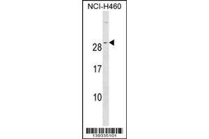 Image no. 1 for anti-Ras-related Protein Ral-A (rala) (AA 158-186), (C-Term) antibody (ABIN1536751)