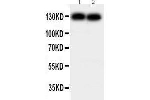 Image no. 1 for anti-Cadherin 2 (CDH2) (AA 701-714), (Middle Region) antibody (ABIN3044370)