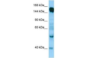 anti-Rap Guanine Nucleotide Exchange Factor (GEF) 6 (RAPGEF6) (N-Term) antibody