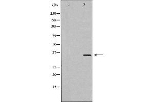 Image no. 2 for anti-G protein beta subunit-like (GBL) antibody (ABIN6263282)
