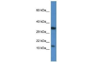 Image no. 1 for anti-Protein Kinase (CAMP-Dependent, Catalytic) Inhibitor beta (PKIB) (Middle Region) antibody (ABIN928978)