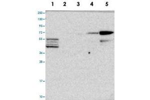 Image no. 3 for anti-CAP-GLY Domain Containing Linker Protein Family, Member 4 (CLIP4) antibody (ABIN5575603)