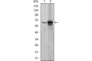 Image no. 2 for anti-FYN Oncogene Related To SRC, FGR, YES (FYN) antibody (ABIN969160)