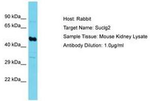 Image no. 1 for anti-Succinate-CoA Ligase, GDP-Forming, beta Subunit (SUCLG2) (AA 101-150) antibody (ABIN6750537)