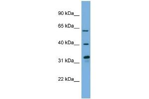 Image no. 1 for anti-Flavin Containing Monooxygenase 3 (FMO3) (N-Term) antibody (ABIN2781861)