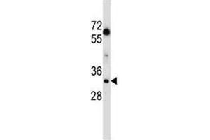 Image no. 4 for anti-Lactate Dehydrogenase A (LDHA) (AA 204-232) antibody (ABIN3031580)