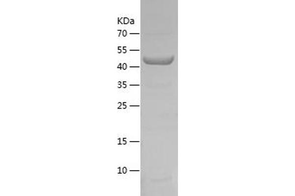 P4HA1 Protein (AA 340-534) (IF2DI tag)