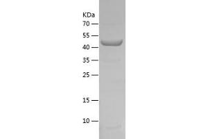 P4HA1 Protein (AA 340-534) (IF2DI tag)