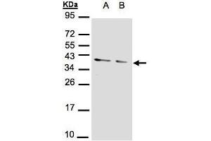 Image no. 3 for anti-Protein Phosphatase 1, Catalytic Subunit, alpha Isoform (PPP1CA) (Center) antibody (ABIN2856071)