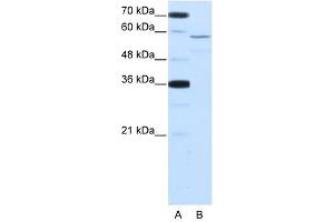 Image no. 1 for anti-Neuro-Oncological Ventral Antigen 2 (NOVA2) (Middle Region) antibody (ABIN629943)