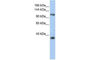Image no. 1 for anti-Zinc Finger E-Box Binding Homeobox 2 (ZEB2) (N-Term) antibody (ABIN2778075)
