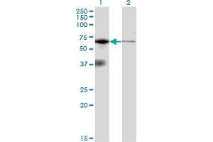 Image no. 3 for anti-Eukaryotic Translation Initiation Factor 2-alpha Kinase 2 (EIF2AK2) (AA 1-100) antibody (ABIN519273)