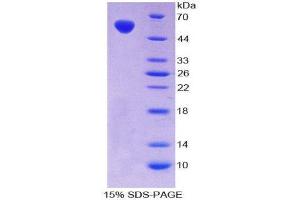 Image no. 1 for V-Fos FBJ Murine Osteosarcoma Viral Oncogene Homolog (FOS) (AA 6-240) protein (His tag,GST tag) (ABIN2123735)