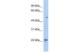 Image no. 1 for anti-Transcription Elongation Factor A (SII)-Like 3 (TCEAL3) (N-Term) antibody (ABIN928434)