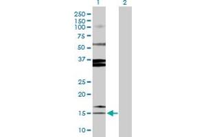 Image no. 2 for anti-serine Peptidase Inhibitor, Kazal Type 1 (SPINK1) (AA 1-79) antibody (ABIN520431)