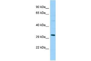 SPSB1 抗体  (Middle Region)