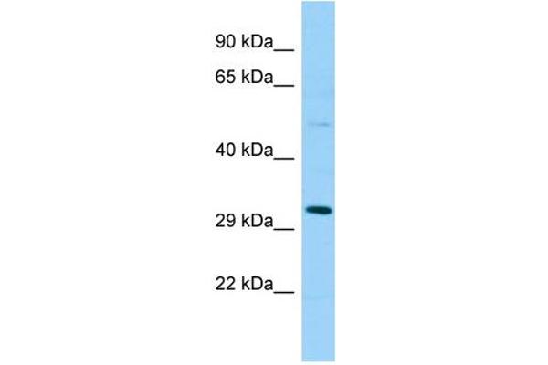 anti-SplA/ryanodine Receptor Domain and SOCS Box Containing 1 (SPSB1) (Middle Region) antibody