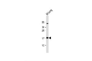 Image no. 7 for anti-Immediate Early Response 3 (IER3) (AA 38-65), (N-Term) antibody (ABIN655735)
