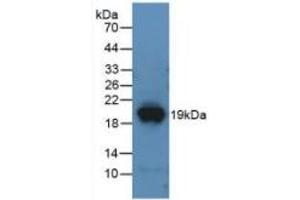 DPP4 ELISA Kit