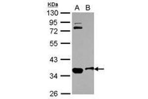 Image no. 1 for anti-Osteopetrosis Associated Transmembrane Protein 1 (OSTM1) (AA 1-334) antibody (ABIN1499928)