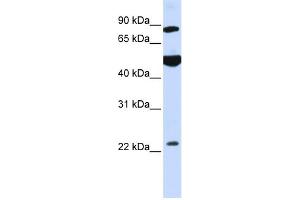 Image no. 1 for anti-Mannosyl-Oligosaccharide Glucosidase (MOGS) (N-Term) antibody (ABIN2782707)