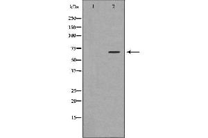 Image no. 1 for anti-Neuroepithelial Cell Transforming 1 (NET1) (C-Term) antibody (ABIN6263601)