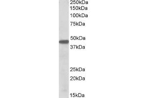 Image no. 2 for anti-Pre-B-Cell Leukemia Homeobox Protein 1 (PBX1) (Internal Region) antibody (ABIN571168)