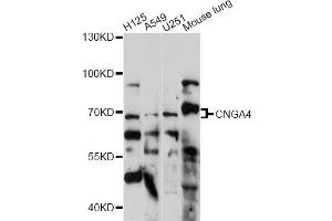 Image no. 1 for anti-Cyclic Nucleotide Gated Channel alpha 4 (CNGA4) antibody (ABIN6291314)