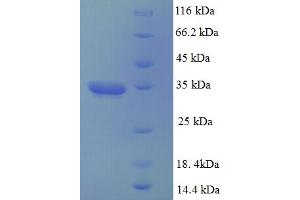 Image no. 1 for Dynactin 3 (p22) (Dctn3) (AA 2-176) protein (His-SUMO Tag) (ABIN5709391)