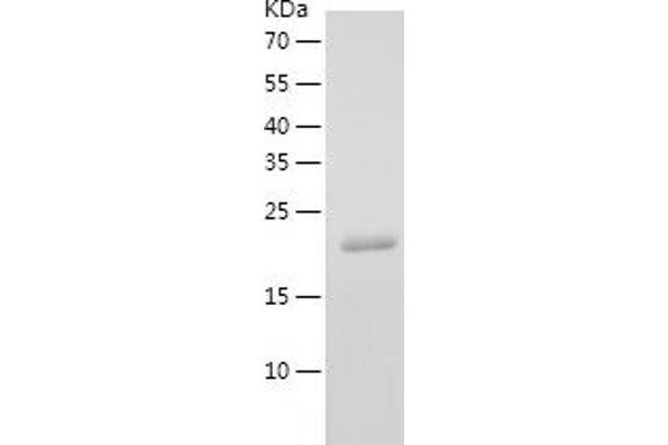 YKT6 Protein (AA 1-198) (His tag)
