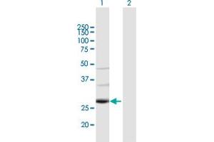 Image no. 1 for anti-TAF9B RNA Polymerase II, TATA Box Binding Protein (TBP)-Associated Factor, 31kDa (TAF9B) (AA 1-251) antibody (ABIN949345)
