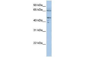 Image no. 2 for anti-Dihydrolipoyl Transacetylase (DLAT) (C-Term) antibody (ABIN2777102)