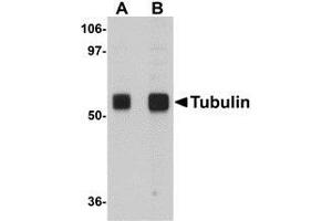 Image no. 1 for anti-Tubulin, alpha 1a (Tuba1a) (N-Term) antibody (ABIN499269)
