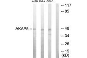 Image no. 1 for anti-A Kinase (PRKA) Anchor Protein 5 (AKAP5) (AA 1-50) antibody (ABIN1533671)