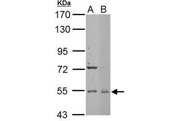 anti-Enhancer of mRNA Decapping 3 (EDC3) (Internal Region) antibody