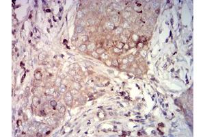 Image no. 4 for anti-Carcinoembryonic Antigen-Related Cell Adhesion Molecule 1 (Biliary Glycoprotein) (CEACAM1) (AA 65-201) antibody (ABIN5684132)