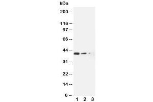 Image no. 1 for anti-ATP-Binding Cassette, Sub-Family C (CFTR/MRP), Member 4 (ABCC4) (N-Term) antibody (ABIN3030054)