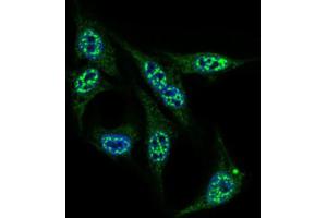 Image no. 1 for anti-Inner Centromere Protein Antigens 135/155kDa (INCENP) (AA 369-583) antibody (ABIN1844019)