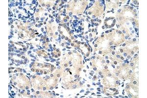 Image no. 1 for anti-Poly(A) Binding Protein, Cytoplasmic 4 (Inducible Form) (PABPC4) (N-Term) antibody (ABIN629988)