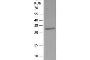 PIH1D2 Protein (AA 1-315) (His tag)