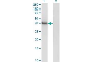 Image no. 3 for anti-Homeobox A11 (HOXA11) (AA 60-166) antibody (ABIN561322)