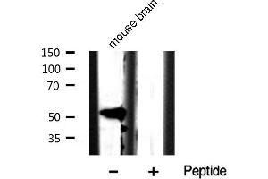 Image no. 2 for anti-Keratin 8 (KRT8) (pSer432) antibody (ABIN6255334)