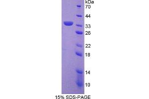 Image no. 1 for Sirtuin 5 (SIRT5) (AA 37-310) protein (His tag) (ABIN6237076)