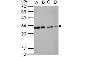 Image no. 3 for anti-Deoxycytidine Kinase (DCK) (Center) antibody (ABIN2855484)