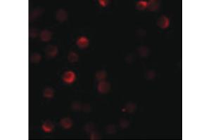 Image no. 2 for anti-Zinc Finger CCCH-Type, Antiviral 1 (ZC3HAV1) (C-Term) antibody (ABIN6655609)