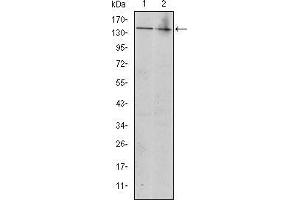 Image no. 2 for anti-Mast/stem Cell Growth Factor Receptor (KIT) antibody (ABIN969237)