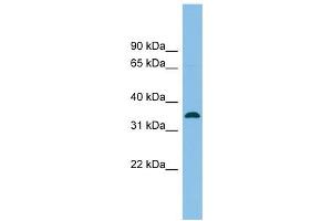 Image no. 1 for anti-Serine Racemase (SRR) (Middle Region) antibody (ABIN632556)