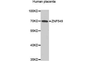 Image no. 2 for anti-Zinc Finger Protein 549 (ZNF549) antibody (ABIN4905684)