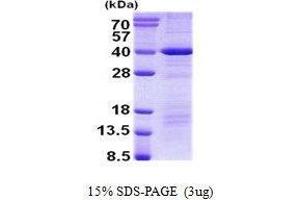 Death Effector Domain Containing (DEDD) protein