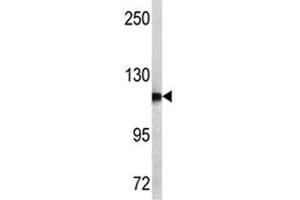 Image no. 3 for anti-Aminopeptidase Puromycin Sensitive (NPEPPS) (AA 709-737) antibody (ABIN3029923)